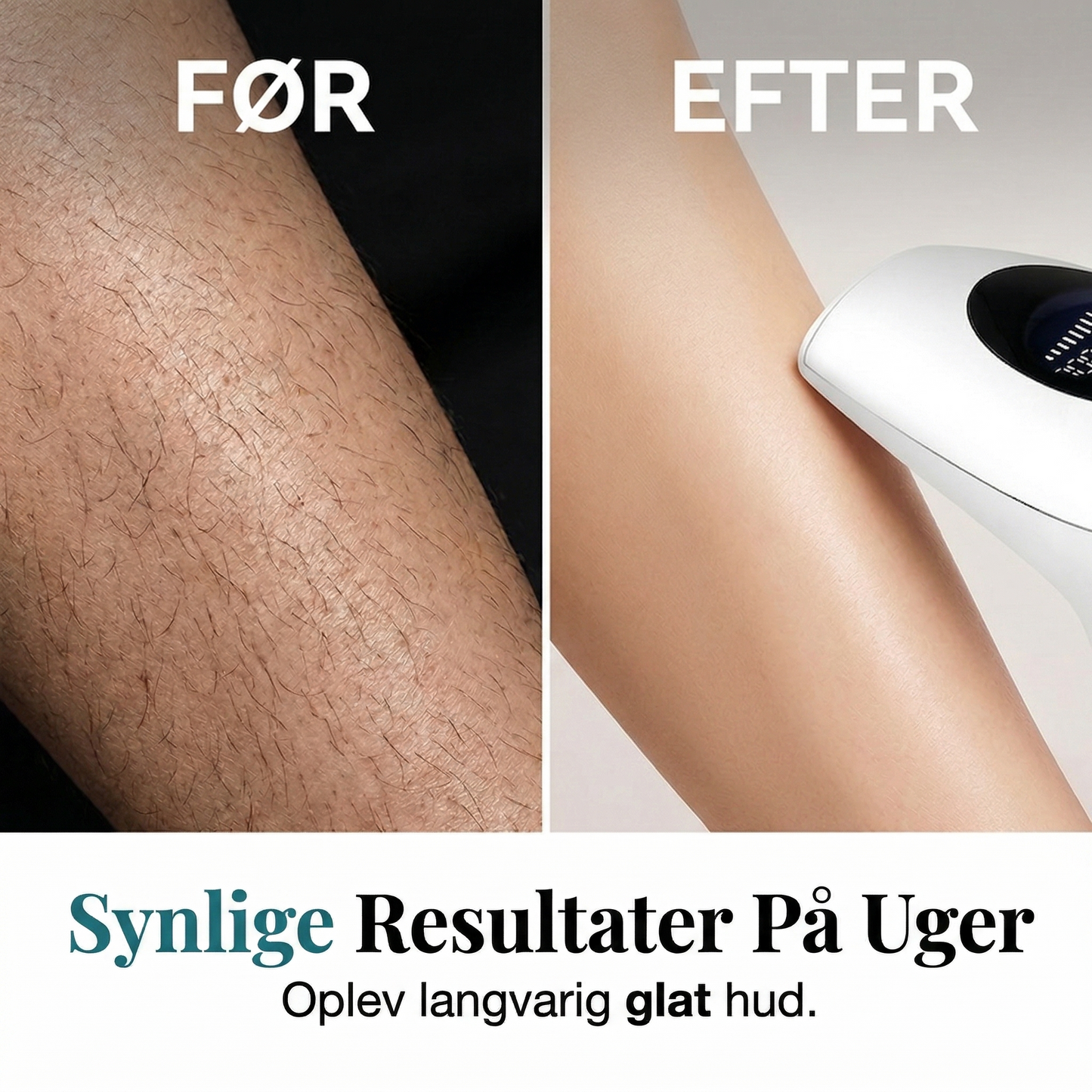 Professionel IPL Laser Hårfjerner (8 Niveauer) – Få Silkeblød Hud i Hjemmet