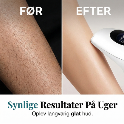 Professionel IPL Laser Hårfjerner (8 Niveauer) – Få Silkeblød Hud i Hjemmet