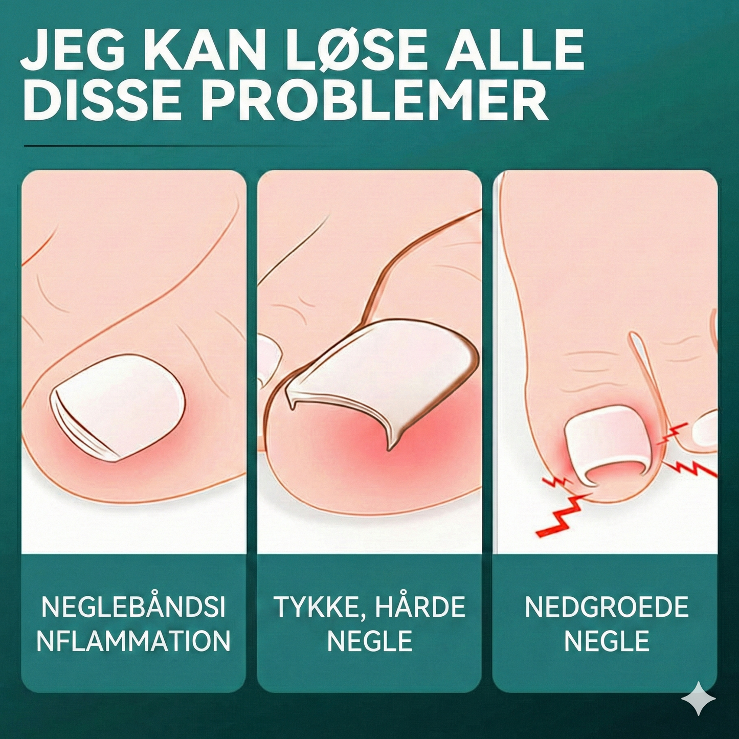 Vinklet Negleklipper med Stor Åbning