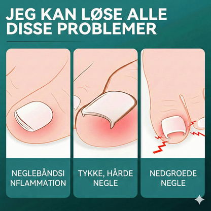 Vinklet Negleklipper med Stor Åbning